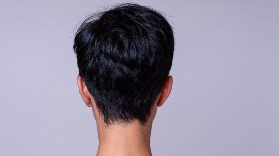 Qué es el pelo ralo en los hombres